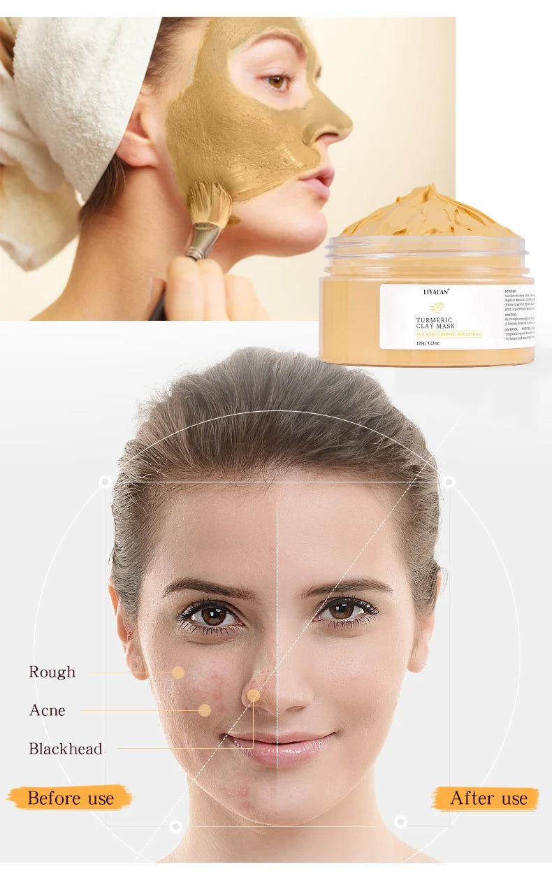 Masque à l'argile et au curcuma pour réduire les points noirs