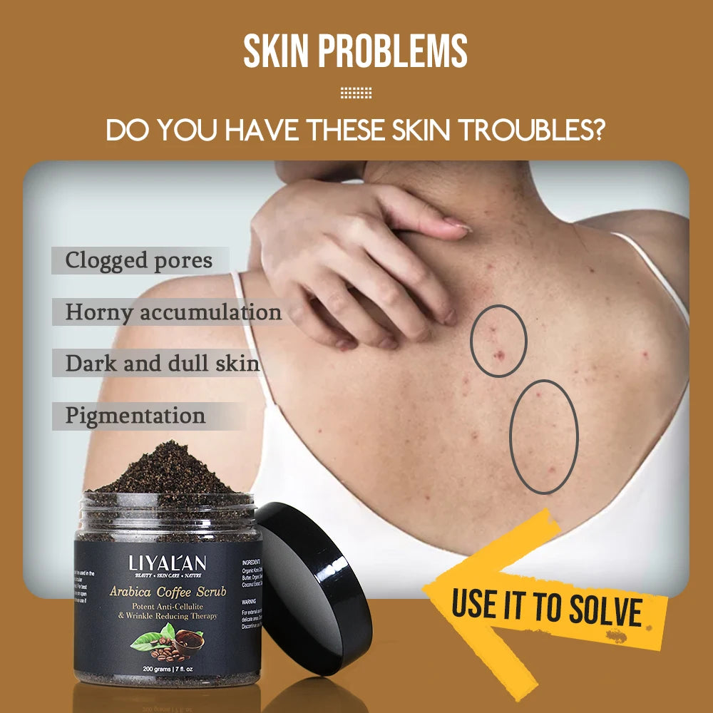 Exfoliante Corporal Hidratante Anticelulítico de Café
