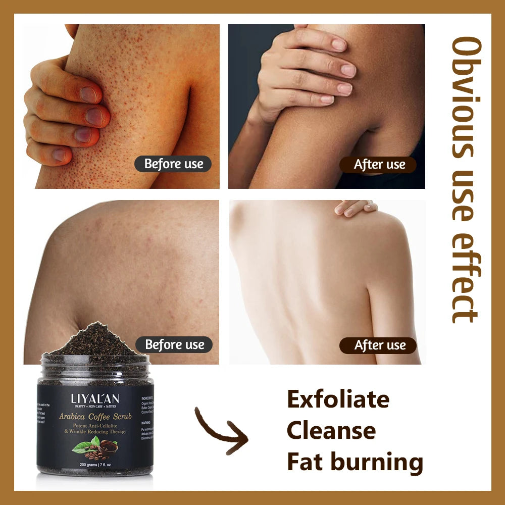 Exfoliante Corporal Hidratante Anticelulítico de Café