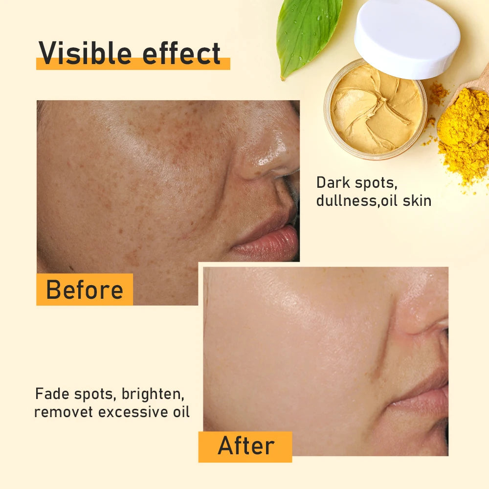 Masque à l'argile et au curcuma pour réduire les points noirs