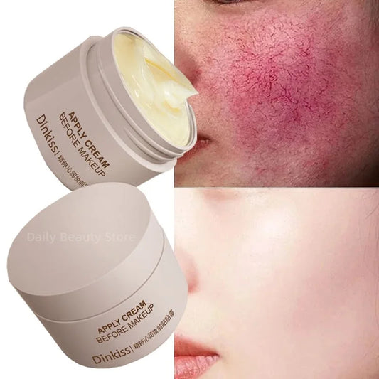 Crema reparadora de enrojecimiento Facial, mejora la sequedad de la piel sensible, loción hidratante para eliminar la rosácea, Cosméticos Coreanos